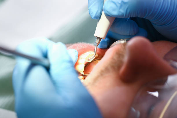 Best Pediatric Emergency Dentist in Suamico, WI